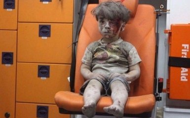 Сеть взорвало видео с сирийским ребенком, выжившим после авиаудара России