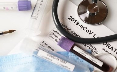 Украинский ученый назвал серьезный недостаток ПЦР-теста на коронавирус