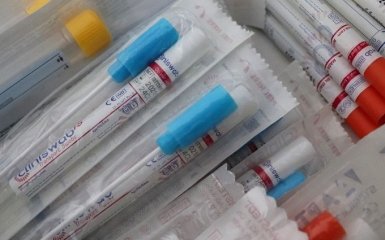 В Украине изменят ПЦР-тесты на коронавирус из-за нового штамма COVID-19