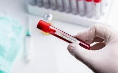 Кількість хворих на коронавірус в Україні нарешті почала знижуватися - офіційні дані на 21 червня