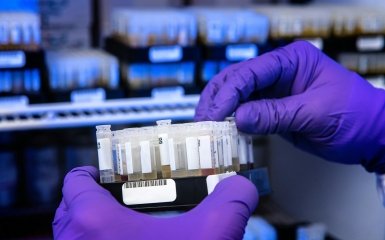 Як обрати глюметр посібник для тих, кому нещодавно діагностували про діабет