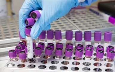 Количество больных коронавирусом в Украине снова возросло - официальные данные на 7 мая