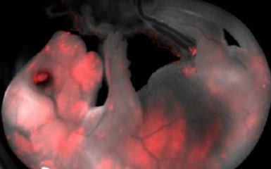 Ученые скрестили человека и свинью: в соцсетях жестко шутят о России