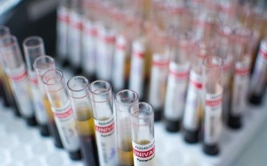 Науковці пояснили, як група крові впливає на ризик виникнення серцево-судинних захворювань