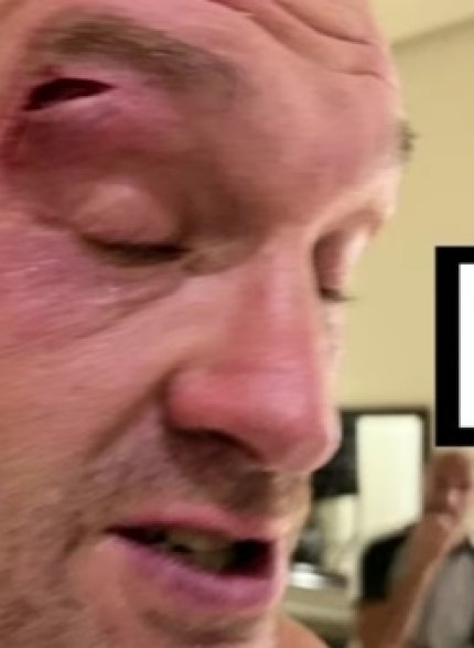  Тайсон Фьюри