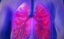 Легені відповідальні за наш імунітет